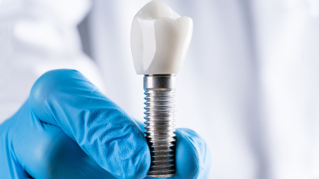 Dental Implant Trends The Advantages of Dental Treatment in Turkey